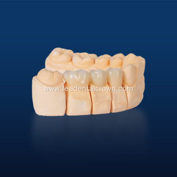 High-Performance Zirconia Materials for Restorative Dentistry